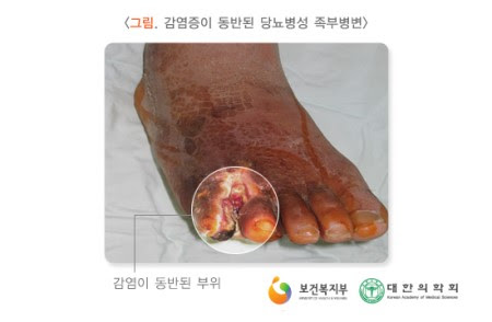 foot and ankle expert_022.jpg