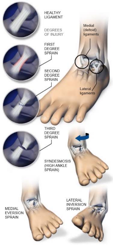 foot and ankle expert_029.jpg